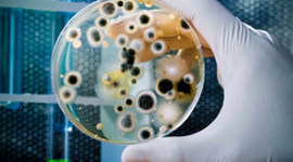 Timeline: History of Bacterial Control