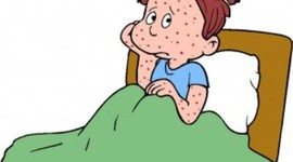 Timeline: History of Varicella