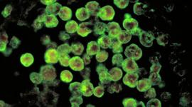 Timeline: Naegleria fowleri