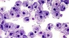 Timeline: Cell Theory