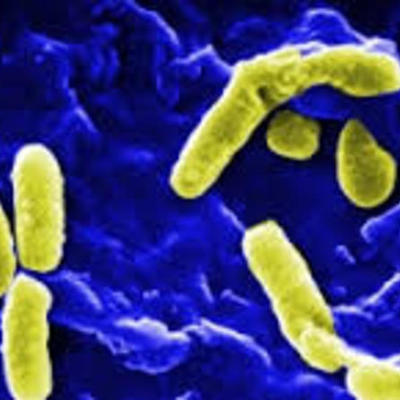 Timeline: Historía de la Microbiología