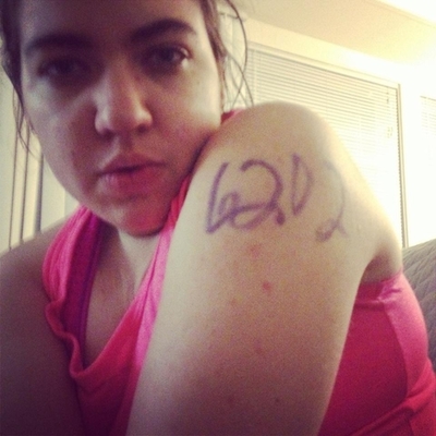 Timeline: Ovarian Fyst's Ankle Injury