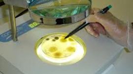 Timeline: Historia de la Microbiologia