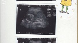 Timeline: La vida de Jenny