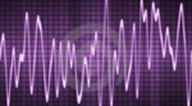 Timeline: l'évolution des appareils de reproduction du son