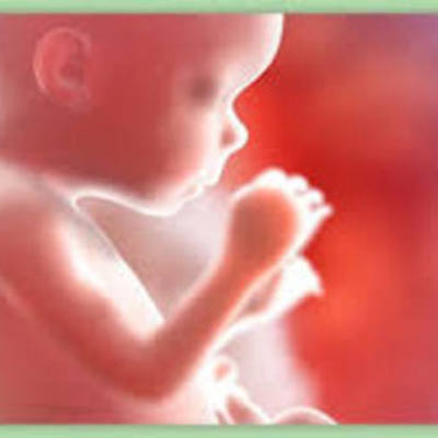 Timeline: causa por la cual las mujeres abortan