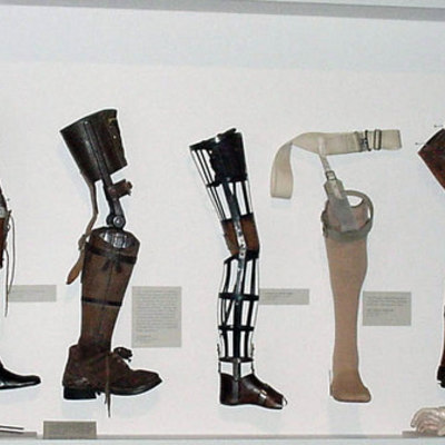 Timeline: Prosthetic Limbs