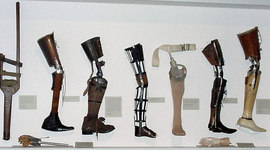 Timeline: Prosthetic Limbs