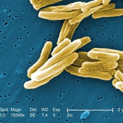 Timeline: Tuberculosis