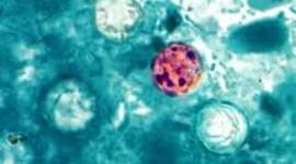 Timeline: Ciclosporosi