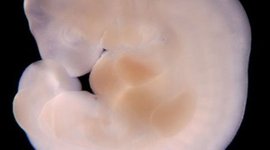 Timeline: desarrollo embrionario y fetal