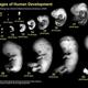 Fetaldevelopment