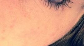 Timeline: Mallorie's Story