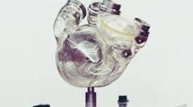 Timeline: The Artificial Heart