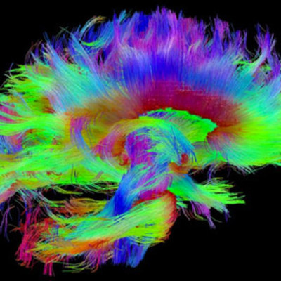 Timeline: History of Medical Imaging