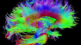 Timeline: History of Medical Imaging