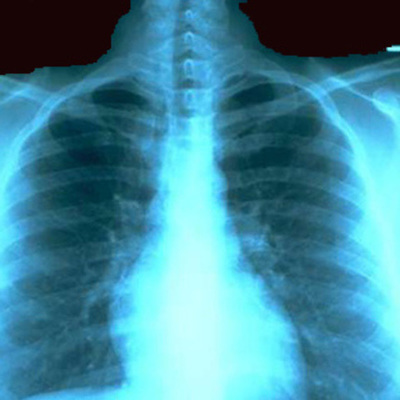 Timeline: History Of Radiology