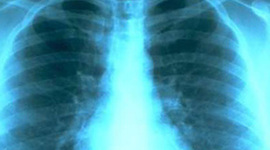 Timeline: History Of Radiology