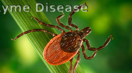 Timeline: Lyme Disease