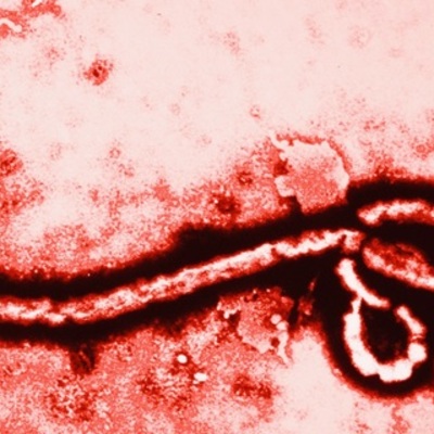 Timeline: History of Ebola