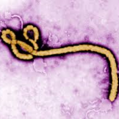 Timeline: History of Ebola 1976-Present