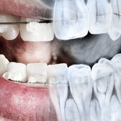 Timeline: HISTORIA DE LA RADIOLOGÍA DENTAL