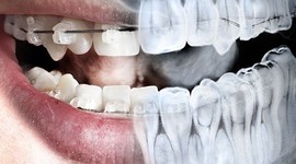 Timeline: HISTORIA DE LA RADIOLOGÍA DENTAL