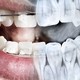 Radiografia dental
