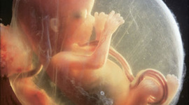 Timeline: Second Trimester