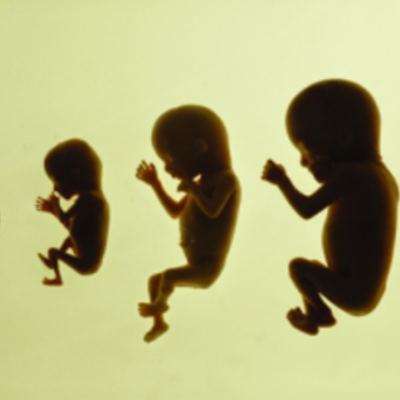 Timeline: Stages of Development