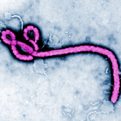 Timeline: History of Ebola