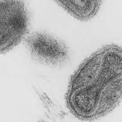 Timeline: Edward Jenner