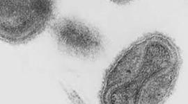 Timeline: Edward Jenner