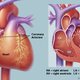 Heart illustration