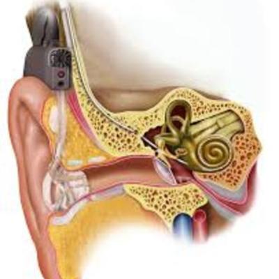 Timeline: Hearing Assisted Devices