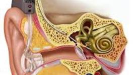 Timeline: Hearing Assisted Devices