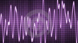 Timeline: L’évolution des appareils de reproduction du son