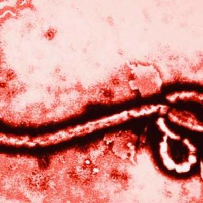 Timeline: Casos de ébola