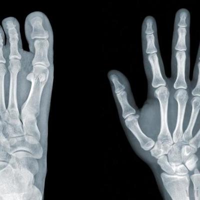 Timeline: discovery of x rays