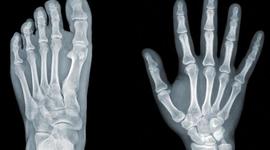Timeline: discovery of x rays