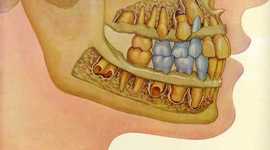 Timeline: ERUPCIÓN DENTARIA