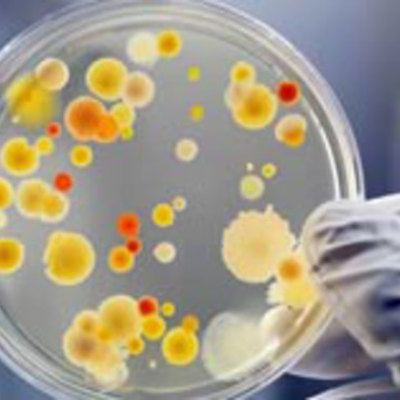 Timeline: LOS 30 EVENTOS MAS IMPORTANTES DE LA MICROBIOLOGIA