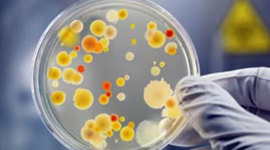 Timeline: LOS 30 EVENTOS MAS IMPORTANTES DE LA MICROBIOLOGIA