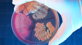 Timeline: HISTORIA DE LA MICROBIOLOGIA