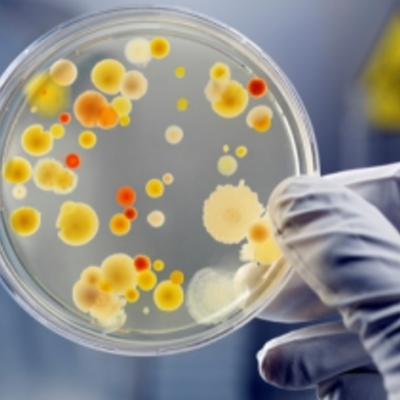 Timeline: HISTORIA DE LA MICROBIOLOGIA