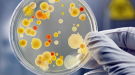 Timeline: HISTORIA DE LA MICROBIOLOGIA