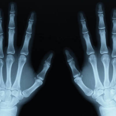 Timeline: History and the evolution of X-rays