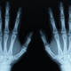 X ray hands