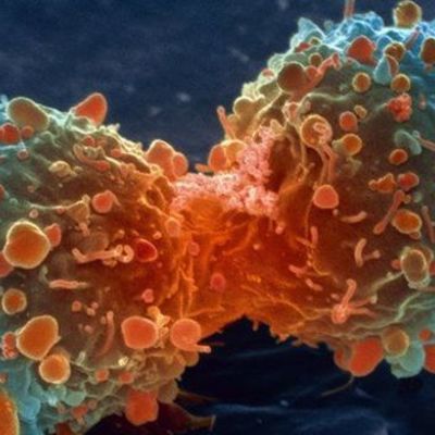 Timeline: The History of Cancer 3000 B.C. - 1928