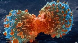 Timeline: The History of Cancer 3000 B.C. - 1928